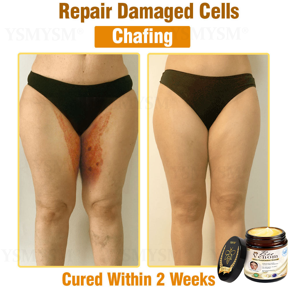 Mayo Clinic Recommended | Official Store | YSMYSM® Full-Body Repair Cream: Anti-Aging, Hydration, Skin Repair, Even Tone, Acne & Dark Spot Treatment, Wart & Mole Removal, Psoriasis Relief